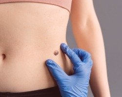 Liposuction & BBL dots