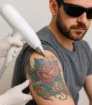 Lasertherapeut gebruikt moderne picolaser op gekleurde rozentattoo op bovenarm van man; realistische close-up zonder zichtbare tekst