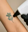 Picoway laser gericht op blauwe bloemvormige tatoeage op onderarm