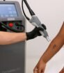 GentleMax Pro laser in gebruik voor het verwijderen van een kleine tattoo op de onderarm