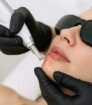 pmu verwijderen voor het verwijderen van permanente make-up op de lippen