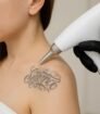 Close up van een tatoeage op de arm tijdens een alternatieve behandeling voor tattoo verwijderen, zonder gebruik van laser.