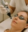 Close-up van een Picoway laserbehandeling met beschermbril voor veilige huidverbetering