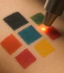 Laser gericht op gekleurde tatoeageblokken voor verwijdering