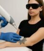 Laser tattoo removal op onderarm met koeling; cliënt met beschermbril in klinische setting.