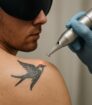 Close-up van laserapparaat tijdens tattoo verwijdering; professionele klinische setting met focus op precisie.
