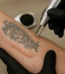 Tattoo verwijdering bij oude, patchy inkt op de onderarm; precisielaser met rode doellicht.