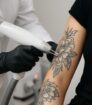 Close up van een specialist die met een laserhandstuk een tatoeage op een onderarm behandelt.