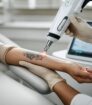 Laserbehandeling verwijdert tatoeage op onderarm in een professionele kliniek