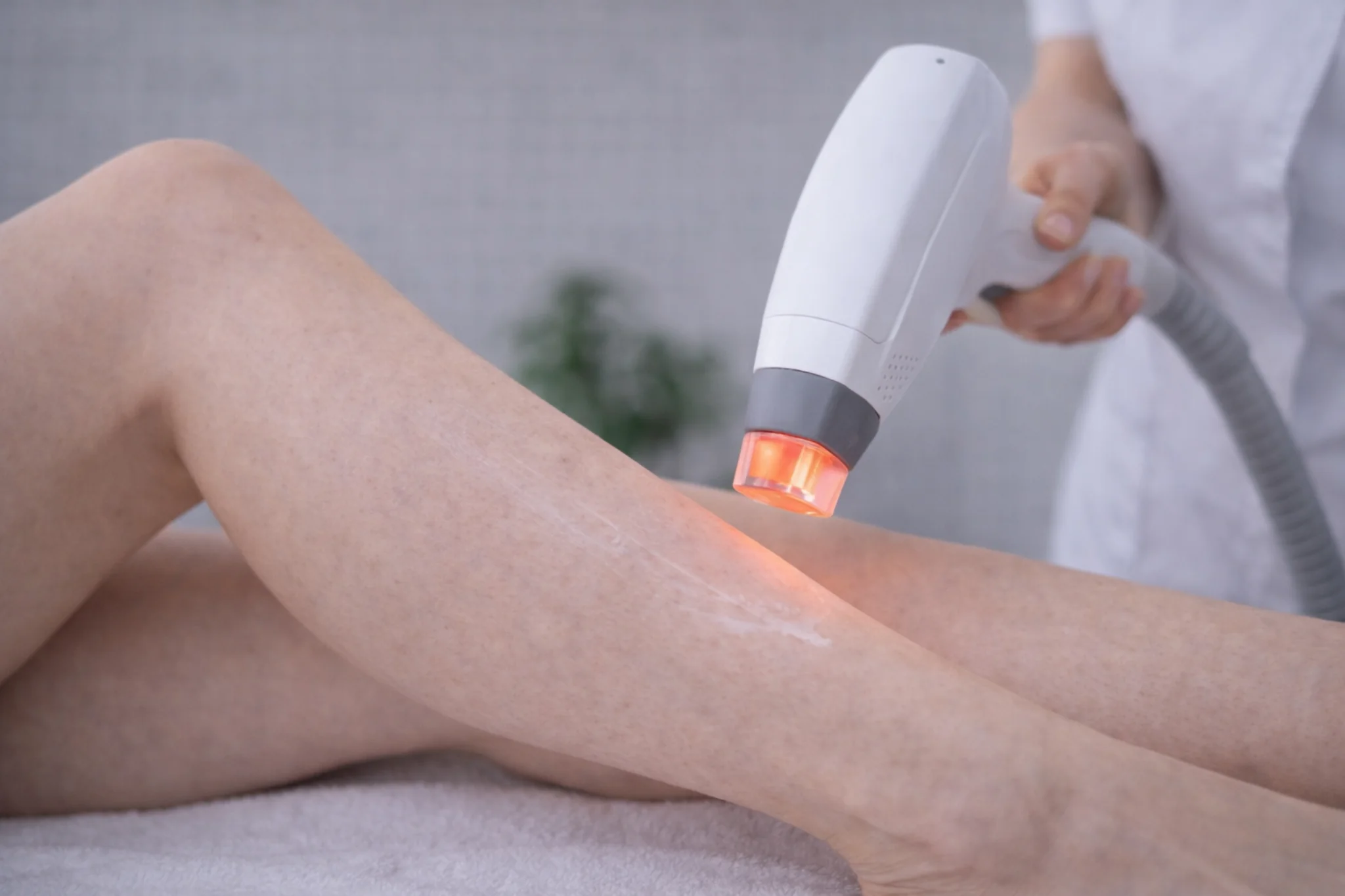 Laserontharing op het onderbeen in een kliniek met professionele apparatuur voor een stabiel behandelritme.