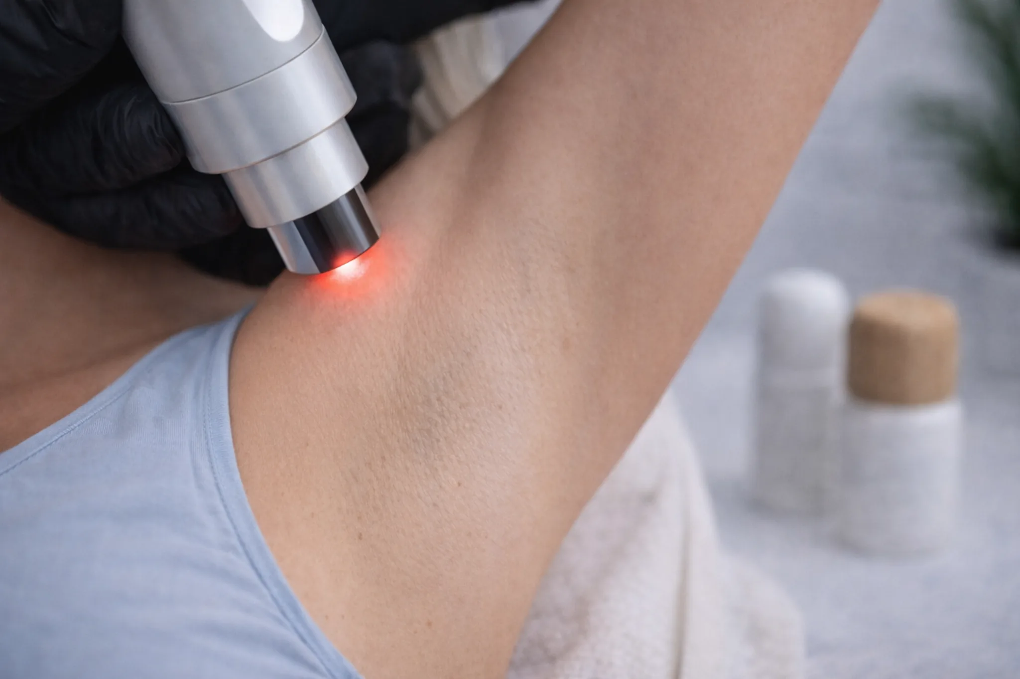 Laserbehandeling van de oksel waarbij een laserhandstuk gericht haarzakjes behandelt in een klinische setting.