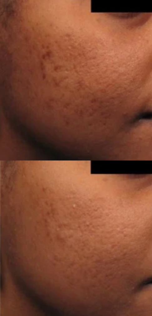 NDN.LASER kliniek in Almere
