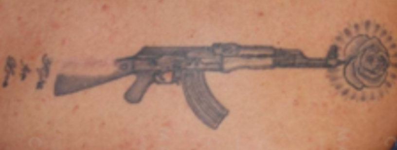 Voor — Voor en na tattoo verwijderen Almere, PicoWay laser