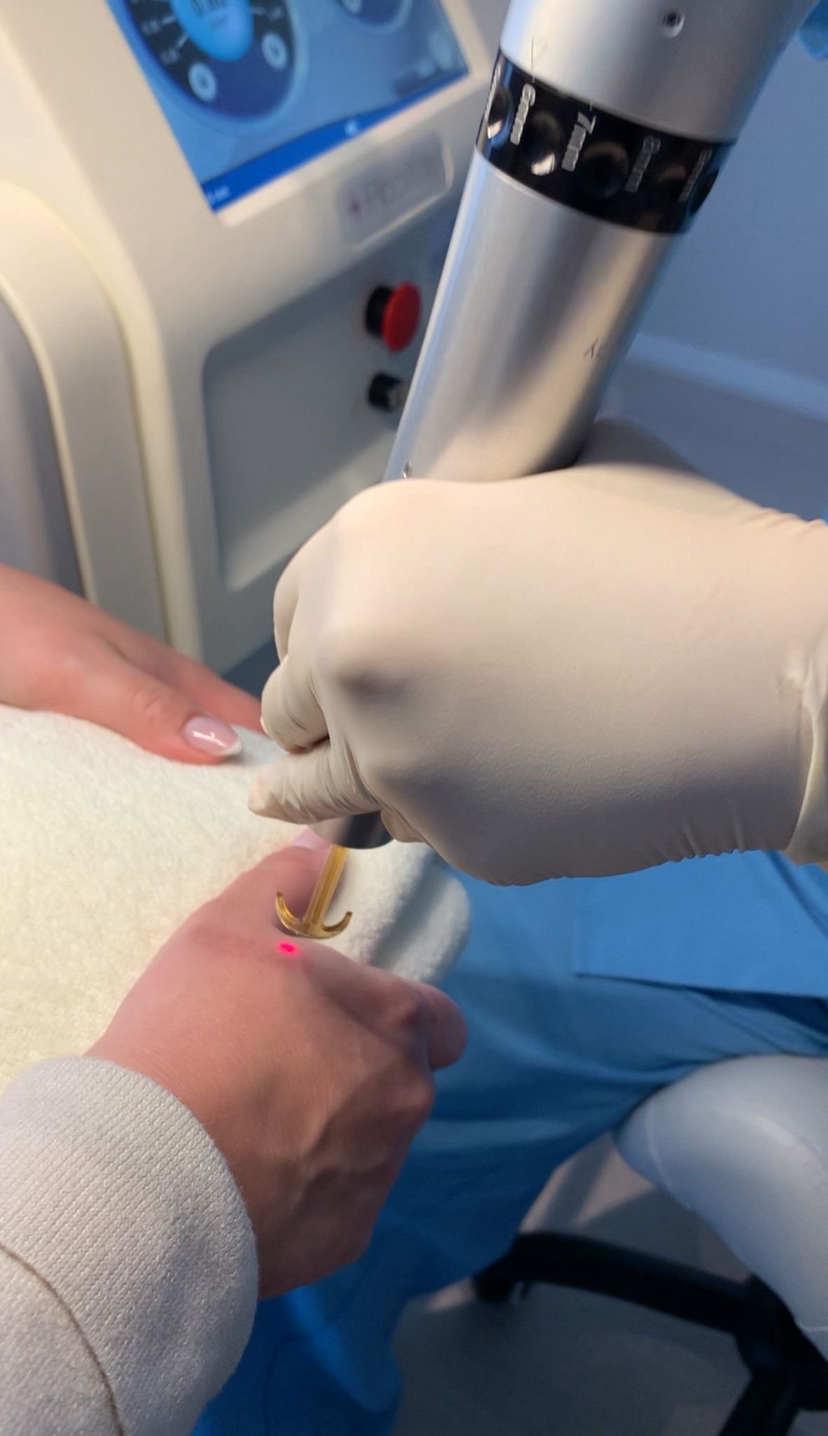 Laser ontharen Almere — NDN.LASER
