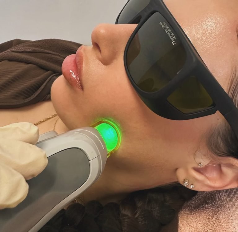 Laser ontharen — NDN.LASER Almere