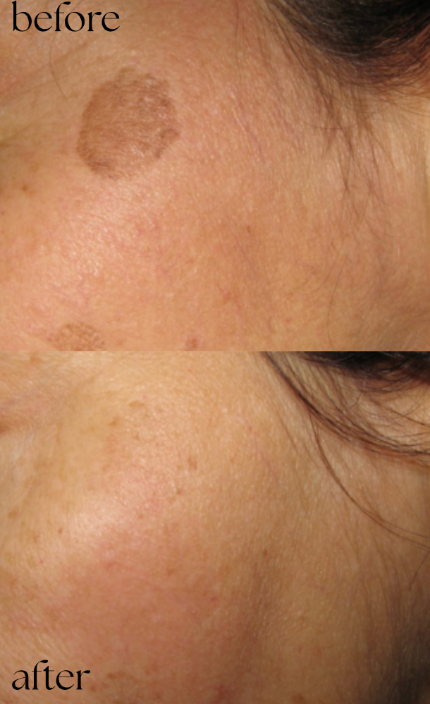 NDN.LASER kliniek in Almere