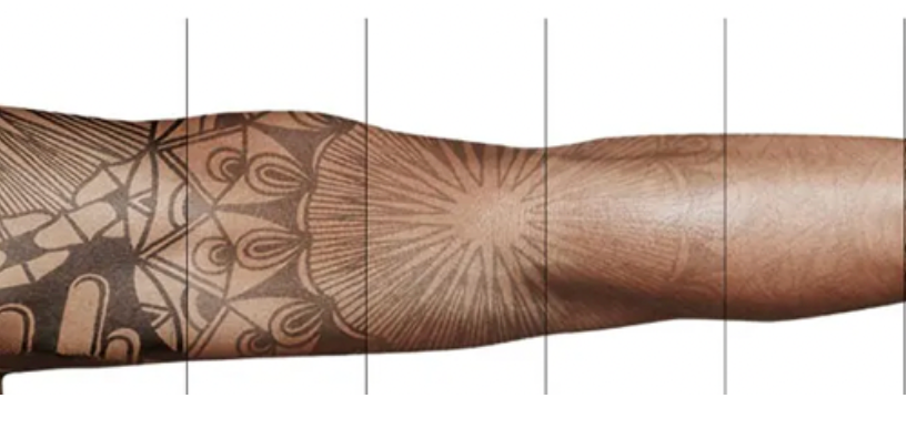 Tattoo verwijderen Almere